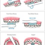 Maintaining Oral Health During Orthodontic Treatment: Tips and Tricks